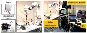 Ultrasound-guided wireless tubular robotic anchoring system