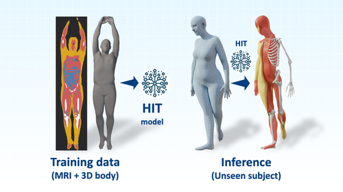 HIT: Estimating Internal Human Implicit Tissues from the Body Surface