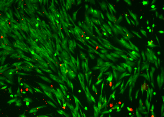 On the spot drug delivery with light-controlled organic microswimmers