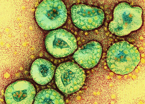 Thumb ticker sm tem of a cluster of corona viruses