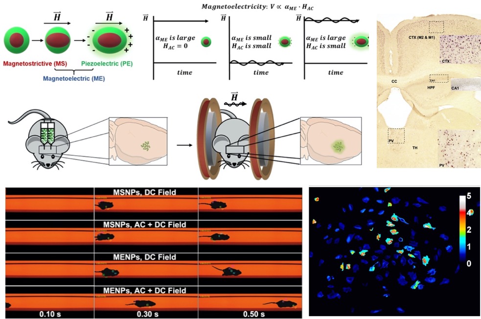 Neurostimulation