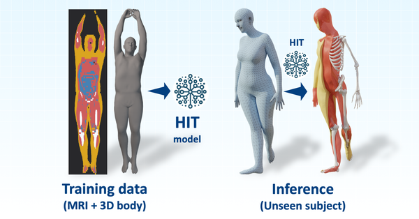 {HIT}: Estimating Internal Human Implicit Tissues from the Body Surface
