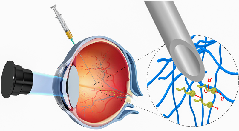 Biomedical systems